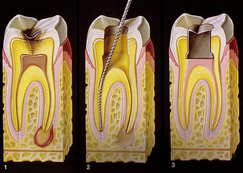 endodontie_cluj