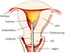 Procedura endoscopica