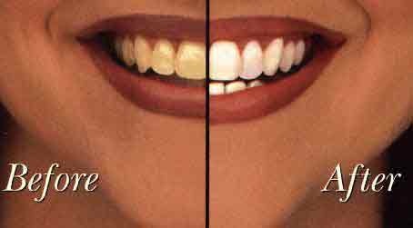 estetica_dentara_cluj