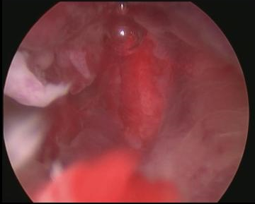 Endoscopie