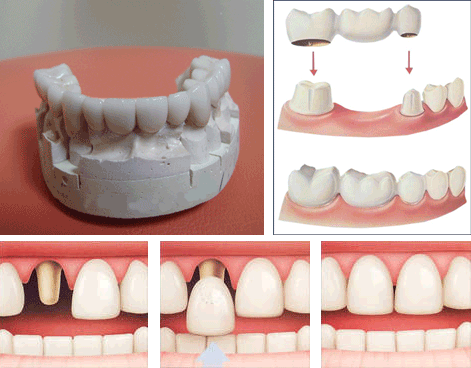 protetica_dentara_cluj